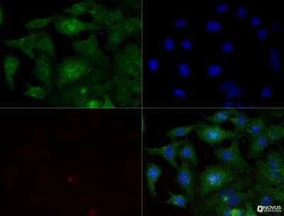 Immunocytochemistry/ Immunofluorescence: Integrin beta 1/CD29 Antibody (P4C10) - BSA Free [NBP2-36561]