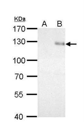 Western Blot: Integrin beta 1/CD29 Antibody [NBP2-16974]