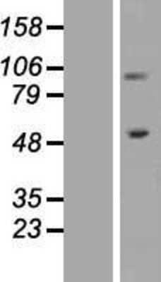 Western Blot: Integrin beta 1/CD29 Overexpression Lysate [NBP2-05862]