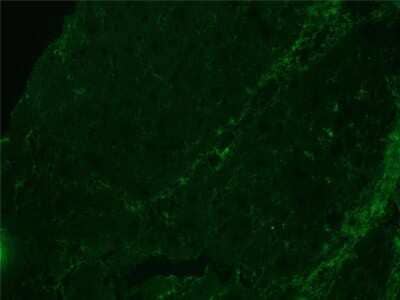 Immunocytochemistry/ Immunofluorescence: Integrin beta 1D Antibody (2B1) - BSA Free [NBP1-97734]