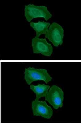 Immunocytochemistry/ Immunofluorescence: Integrin beta 1D Antibody (AT47E2) - BSA Free [NBP2-61161]