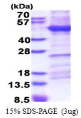 SDS-PAGE: Recombinant Human Integrin beta 1D His Protein [NBP2-23144]