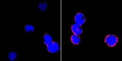 Immunocytochemistry/ Immunofluorescence: Integrin beta 2/CD18 Antibody (10E12) - BSA Free [NBP1-47440]