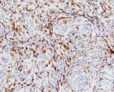 Immunohistochemistry-Paraffin: Integrin beta 2/CD18 Antibody (10E12) - BSA Free [NBP1-47440]
