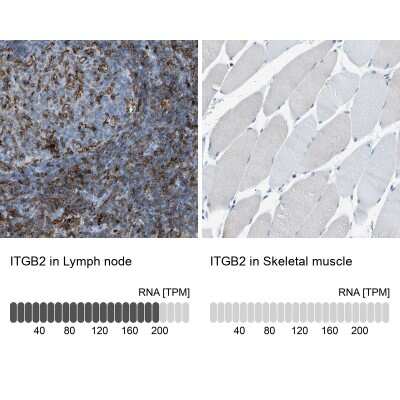 Immunohistochemistry-Paraffin: Integrin beta 2/CD18 Antibody [NBP1-88127]