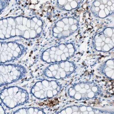 Immunohistochemistry-Paraffin: Integrin beta 2/CD18 Antibody [NBP1-88127]