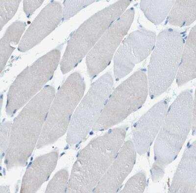 Immunohistochemistry-Paraffin: Integrin beta 2/CD18 Antibody [NBP1-88127]