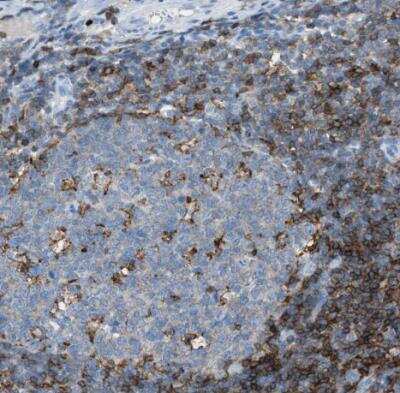 Immunohistochemistry-Paraffin: Integrin beta 2/CD18 Antibody [NBP1-88127]