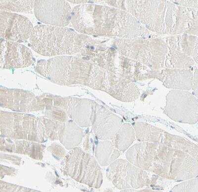 Immunohistochemistry-Paraffin: Integrin beta 2/CD18 Antibody [NBP1-88128]