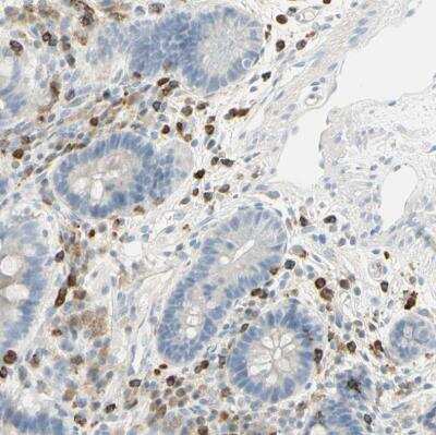 Immunohistochemistry-Paraffin: Integrin beta 2/CD18 Antibody [NBP1-88128]
