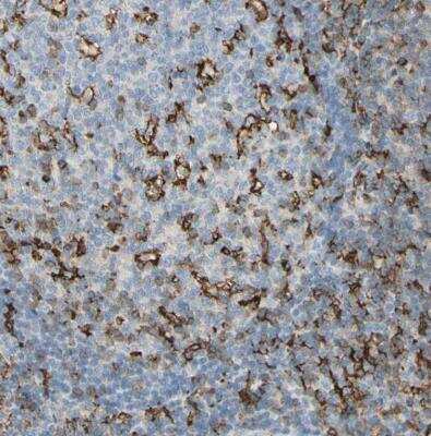 Immunohistochemistry-Paraffin: Integrin beta 2/CD18 Antibody [NBP1-88128]