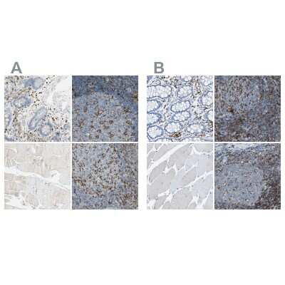 Immunohistochemistry-Paraffin: Integrin beta 2/CD18 Antibody [NBP1-88128]