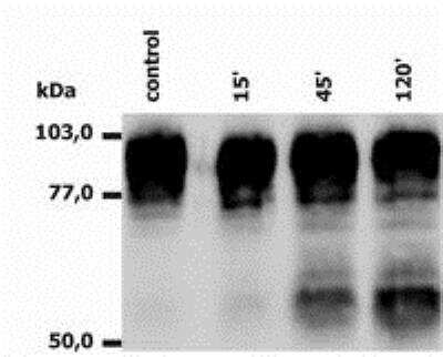 Western Blot: Integrin beta 2/CD18 Antibody (MEM-148)BSA Free [NB500-480]