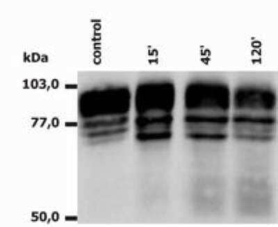 Western Blot: Integrin beta 2/CD18 Antibody (MEM-148)BSA Free [NB500-480]