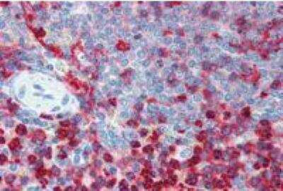 Immunohistochemistry-Paraffin: Integrin beta 2/CD18 Antibody (MEM-48) - BSA Free [NB500-379]