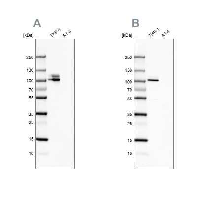 Western Blot: Integrin beta 2/CD18 Antibody [NBP1-88128]