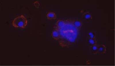 Immunocytochemistry/ Immunofluorescence: Integrin beta 2/CD18 Antibody (YFC118.3) - BSA Free [NB200-610]
