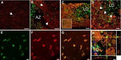 Immunocytochemistry/ Immunofluorescence: Integrin beta 2/CD18 Antibody (YFC118.3) - BSA Free [NB200-610]