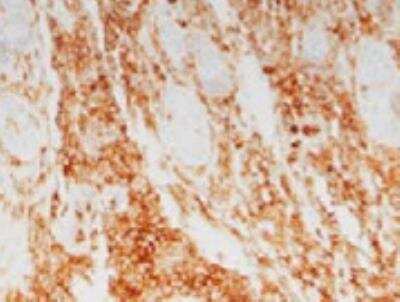 Immunohistochemistry-Frozen: Integrin beta 2/CD18 Antibody (YFC118.3) - BSA Free [NB200-610]