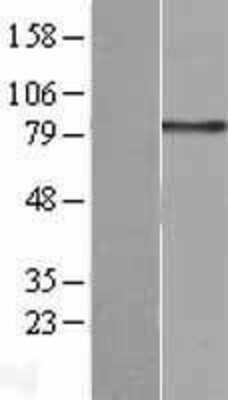 Western Blot: Integrin beta 2/CD18 Overexpression Lysate [NBP2-11372]