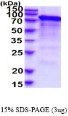 SDS-PAGE: Recombinant Human Integrin beta 2/CD18 His Protein [NBP2-52351]