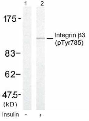 Western Blot: Integrin beta 3/CD61 [p Tyr785] Antibody [NB100-81995]