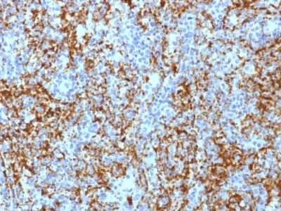 Immunohistochemistry-Paraffin: Integrin beta 3/CD61 Antibody (ITGB3/1713) [NBP2-53393]