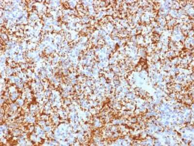 Immunohistochemistry-Paraffin: Integrin beta 3/CD61 Antibody (ITGB3/2166R) - Azide and BSA Free [NBP3-08291]