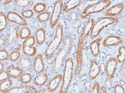Immunohistochemistry-Paraffin: Integrin beta 3/CD61 Antibody (ITGB3/2166R) - Azide and BSA Free [NBP3-08291]