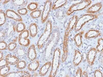 Immunohistochemistry-Paraffin: Integrin beta 3/CD61 Antibody (ITGB3/2166R) [NBP3-07558]