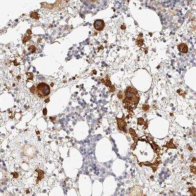 Immunohistochemistry-Paraffin: Integrin beta 3/CD61 Antibody [NBP1-83453]