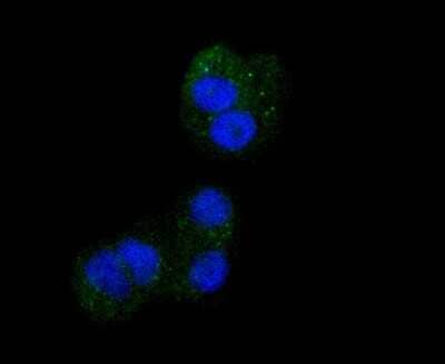 Immunocytochemistry/ Immunofluorescence: Integrin beta 3/CD61 Antibody (SJ19-09) [NBP2-67416]