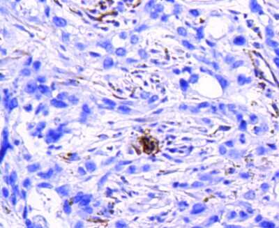 Immunohistochemistry-Paraffin: Integrin beta 3/CD61 Antibody (SJ19-09) [NBP2-67416]
