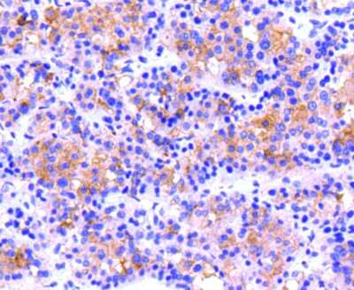 Immunohistochemistry-Paraffin: Integrin beta 3/CD61 Antibody (SJ19-09) [NBP2-67416]