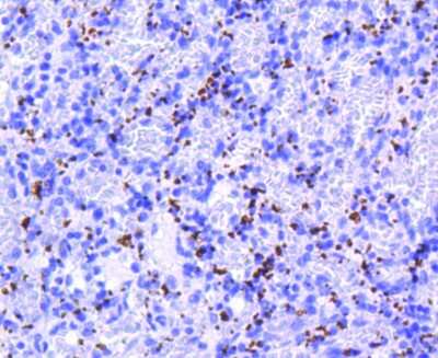 Immunohistochemistry-Paraffin: Integrin beta 3/CD61 Antibody (SJ19-09) [NBP2-67416]