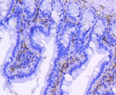 Immunohistochemistry-Paraffin: Integrin beta 3/CD61 Antibody (SJ19-09) [NBP2-67416]