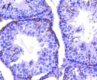 Immunohistochemistry-Paraffin: Integrin beta 3/CD61 Antibody (SJ19-09) [NBP2-67416]