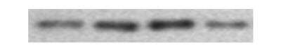 Western Blot: Integrin beta 3/CD61 Antibody (SJ19-09) [NBP2-67416]