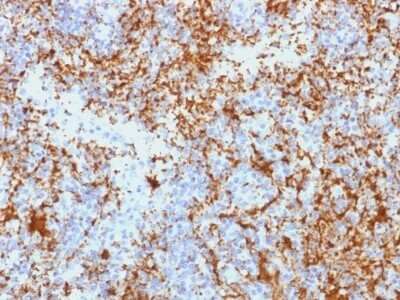 Immunohistochemistry-Paraffin: Integrin beta 3/CD61 Antibody (Y2/51) [NBP2-53414]