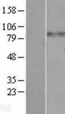 Western Blot: Integrin beta 3/CD61 Overexpression Lysate [NBL1-12073]