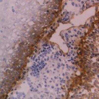 Immunohistochemistry-Frozen: Integrin beta 4/CD104 Antibody (450-9D) - BSA Free [NB100-65599]