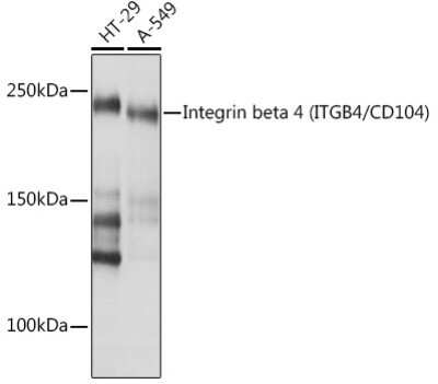 Western Blot: Integrin beta 4/CD104 Antibody (5Z9P3) [NBP3-16446]