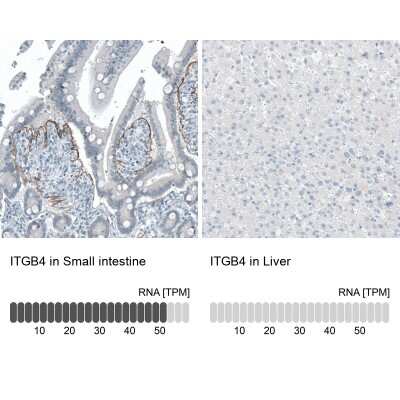 Immunohistochemistry-Paraffin: Integrin beta 4/CD104 Antibody (CL6972) [NBP2-76524]