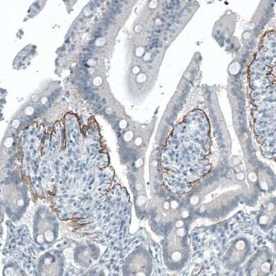 Immunohistochemistry-Paraffin: Integrin beta 4/CD104 Antibody (CL6972) [NBP2-76524]