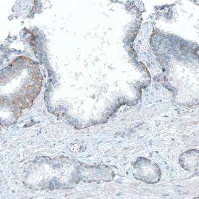 Immunohistochemistry-Paraffin: Integrin beta 4/CD104 Antibody (CL6972) [NBP2-76524]