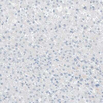 Immunohistochemistry-Paraffin: Integrin beta 4/CD104 Antibody (CL6972) [NBP2-76524]