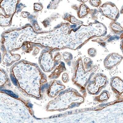 Immunohistochemistry-Paraffin: Integrin beta 4/CD104 Antibody (CL6972) [NBP2-76524]