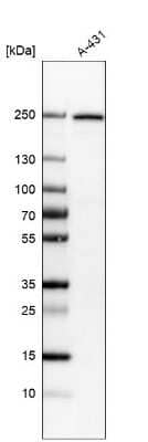 Western Blot: Integrin beta 4/CD104 Antibody (CL6972) [NBP2-76524]