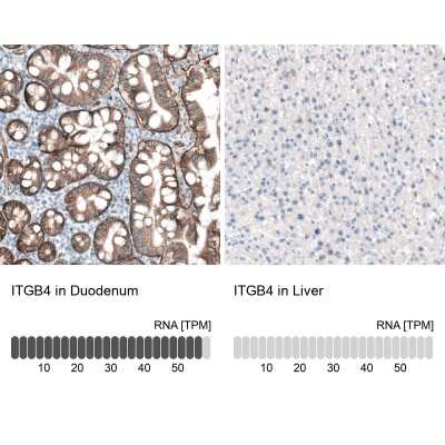 Immunohistochemistry-Paraffin: Integrin beta 4/CD104 Antibody (CL6973) [NBP2-76525]