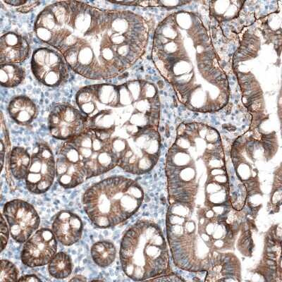 Immunohistochemistry-Paraffin: Integrin beta 4/CD104 Antibody (CL6973) [NBP2-76525]
